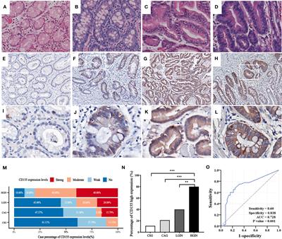 Clinical significance of CD155 expression and correlation with cellular components of tumor microenvironment in gastric adenocarcinoma